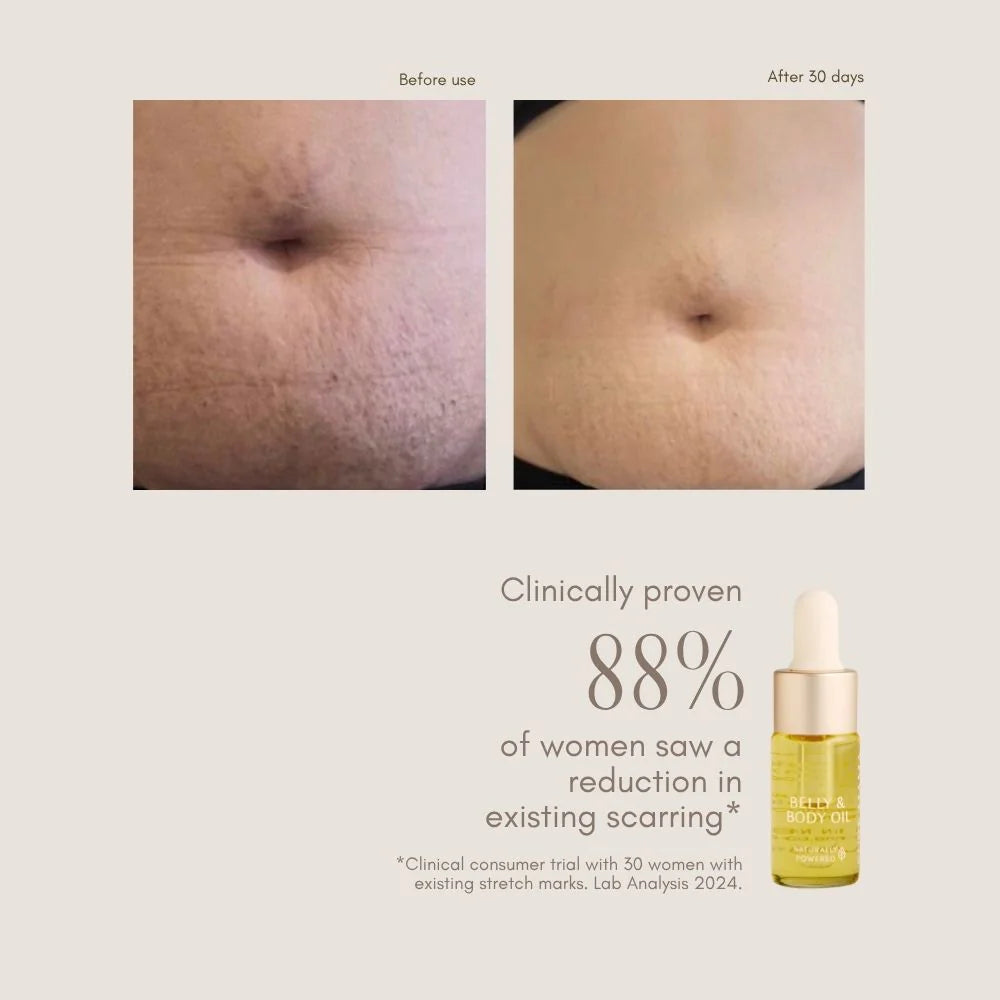 Belly & Body Oil - 10mL - Tester Size | Pure Mama