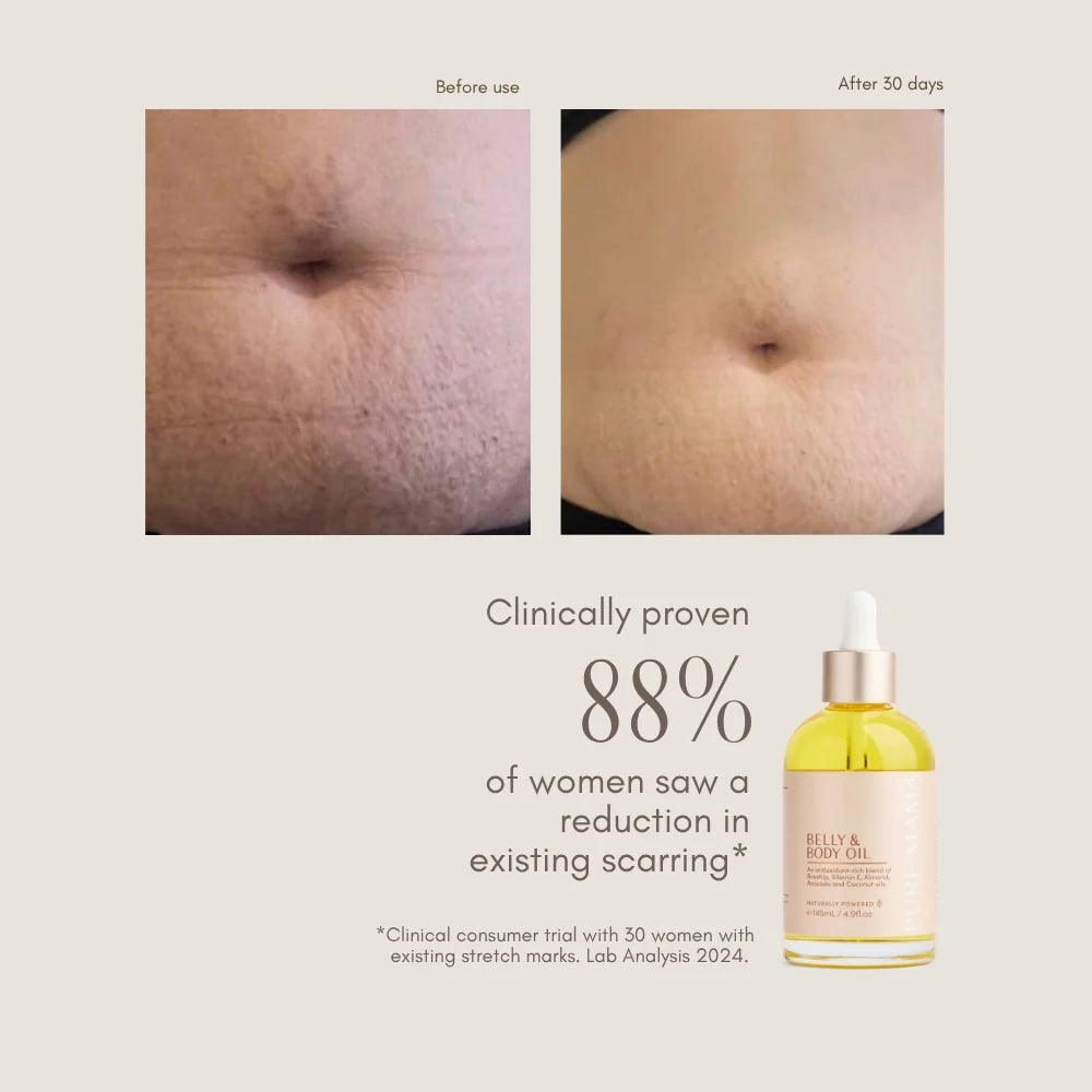 Belly Oil | Pure Mama