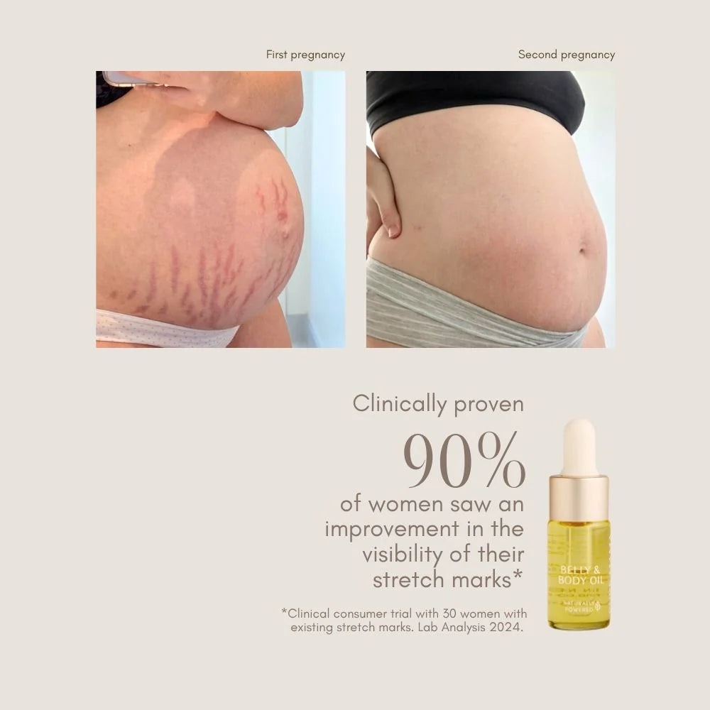 Belly & Body Oil - 10mL - Tester Size | Pure Mama