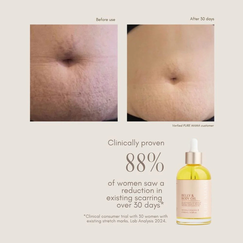 Belly & Body Oil - 145mL | Pure Mama